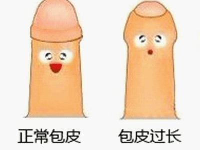 孩子多大割包皮好 给小孩割包皮有哪些好处