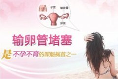 输卵管堵塞检查方法有哪